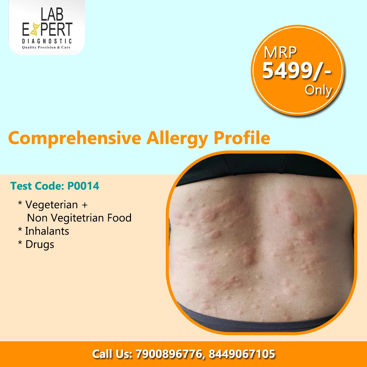 Comprehensive Allergy Profile